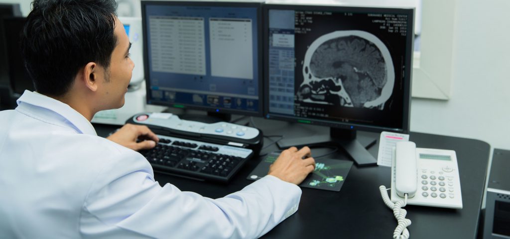 Radiology workstation showing CT head