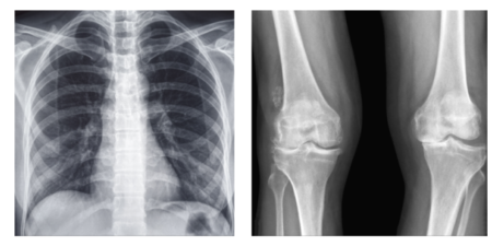 Plain x-ray films of facial bones, chest, knees and abdomen